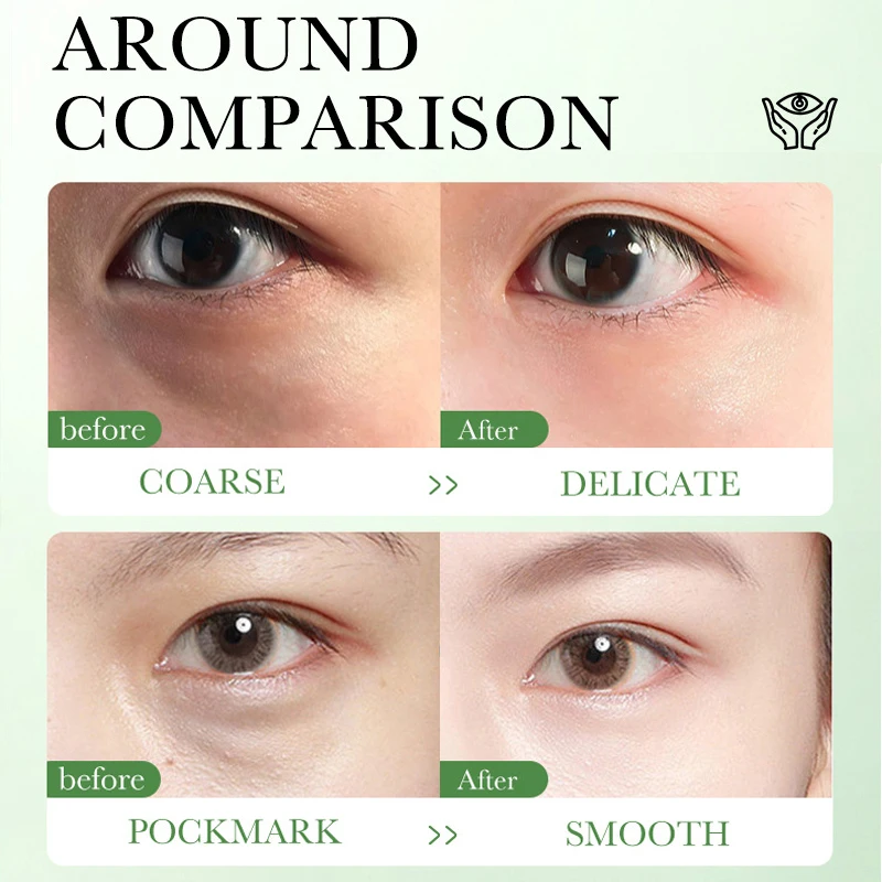 Centella Asiatica Eye Cream Mo - Beauty Huda Makeup recension och pris